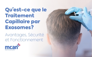 Greffe de Cheveux DHI en Turquie 53 fr What Is Exosome Hair Treatment fr What Is Exosome Hair Treatment