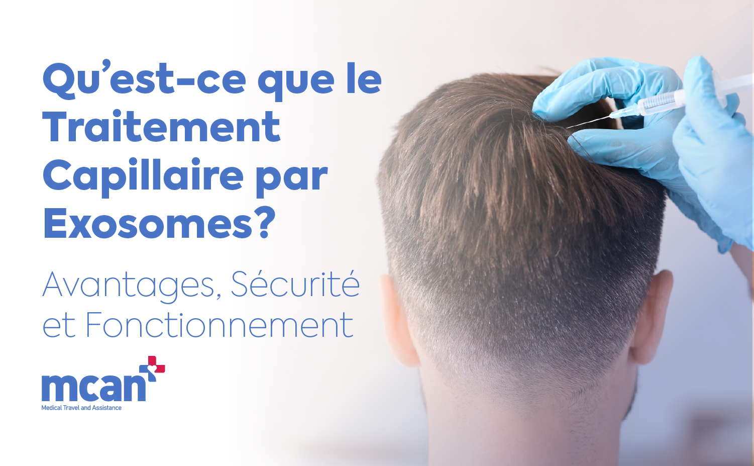 fr What Is Exosome Hair Treatment