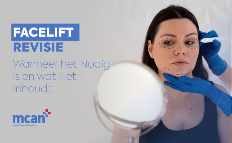 Facelift-revisie: wanneer het nodig is en wat het inhoudt 12 nl Revision Facelift Surgery nl Revision Facelift Surgery