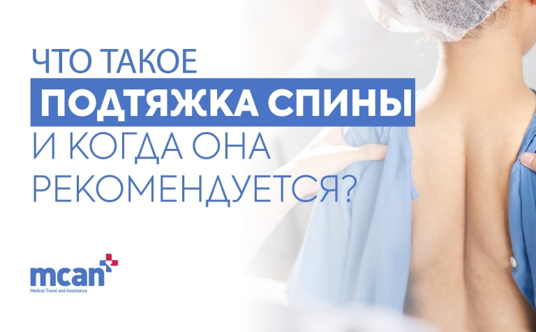 Что такое подтяжка спины и когда она рекомендуется? 8 ru 1 ru 1