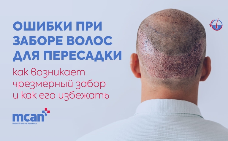 Ошибки при заборе волос для пересадки: как возникает чрезмерный забор и как его избежать 7 ru ru