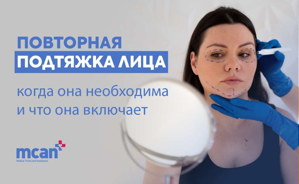 ru Revision Facelift Surgery