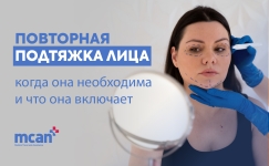 ru Revision Facelift Surgery