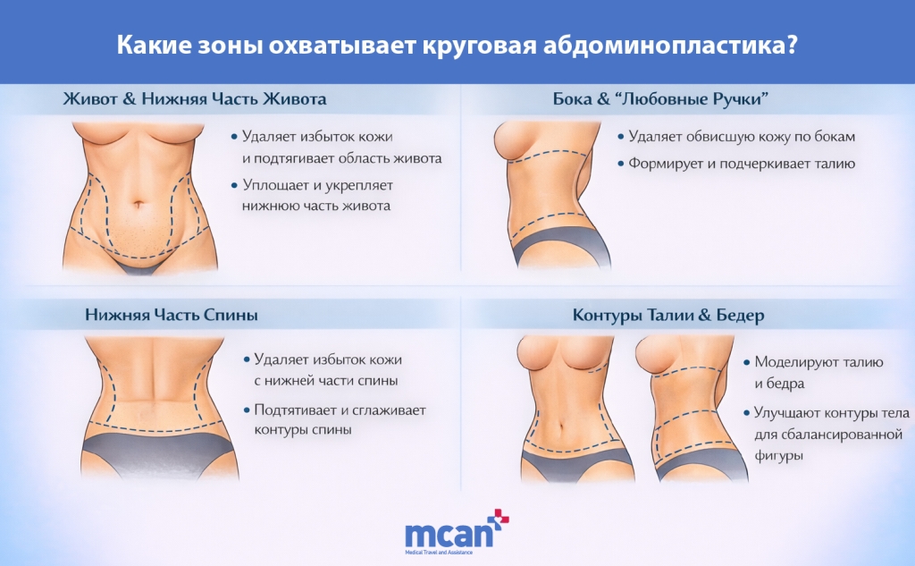 Циркулярная абдоминопластика: как проходит операция и кому она подходит 2 ru What Areas Does a Circumferential Tummy Tuck Treat ru What Areas Does a Circumferential Tummy Tuck Treat