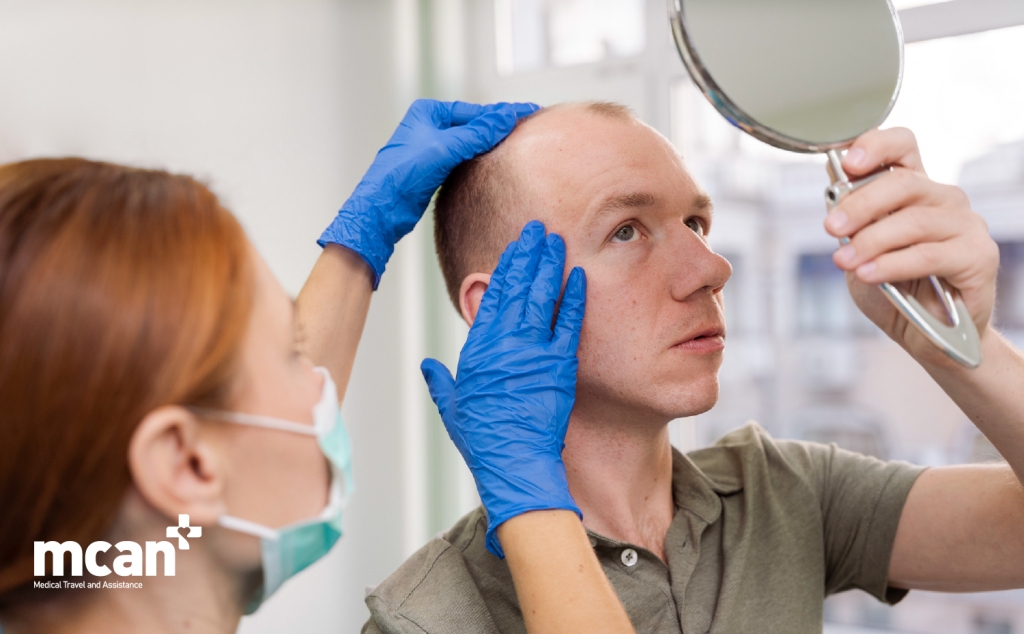 Can Hair Transplants Cause Keloid Scars