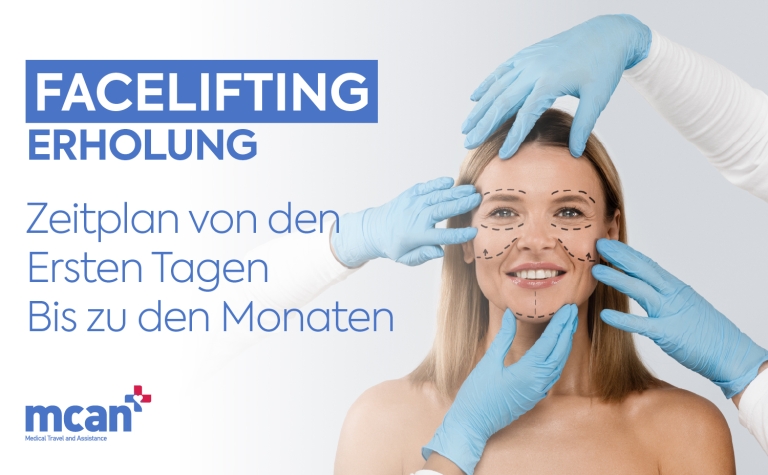 Facelifting Erholung: Zeitplan von den ersten Tagen bis zu den Monaten 8 DE Facelift Recovery Timeline Facelifting Erholung: Zeitplan von den ersten Tagen bis zu den Monaten