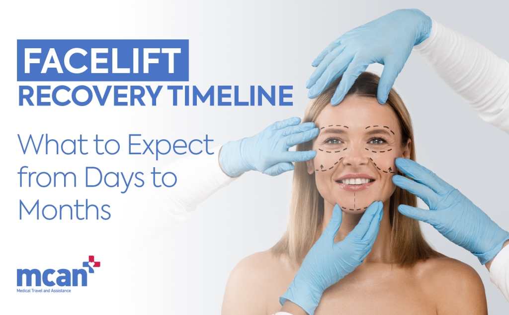 EN Facelift Recovery Timeline