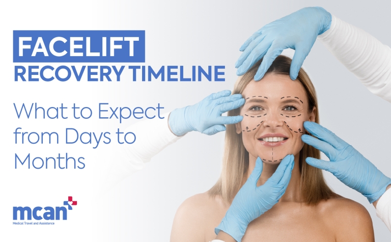 Facelift in Turkey 84 EN Facelift Recovery Timeline Facelift Recovery Timeline: What to Expect from Days to Months
