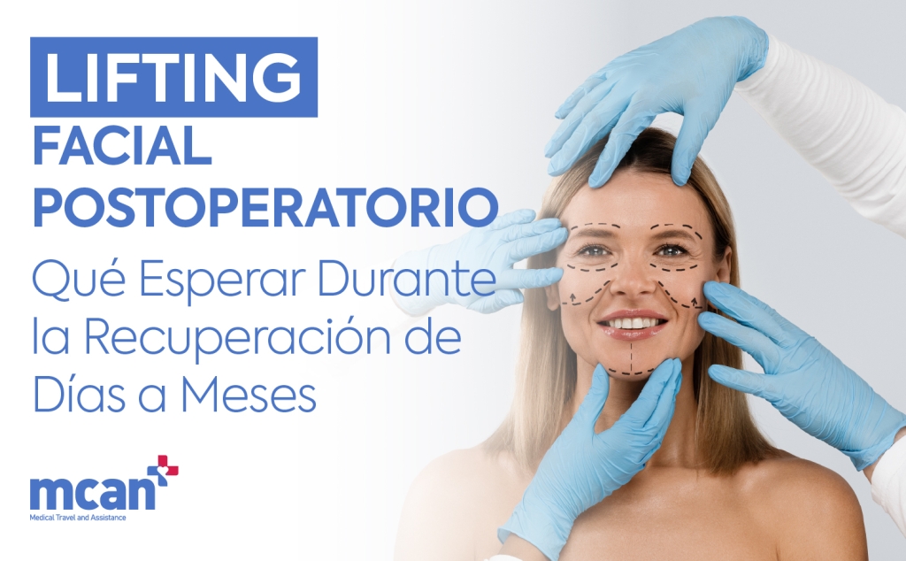 Lifting facial postoperatorio: qué esperar durante la recuperación de días a meses 1 ES Facelift Recovery Timeline Lifting facial postoperatorio: qué esperar durante la recuperación de días a meses