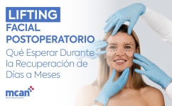 Lifting facial postoperatorio: qué esperar durante la recuperación de días a meses