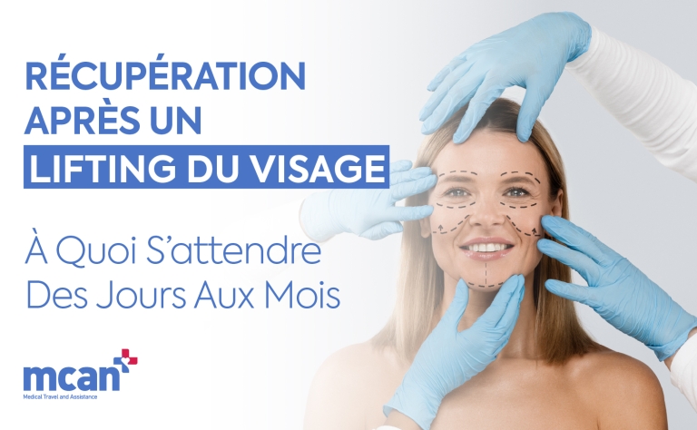 Récupération après un lifting du visage : à quoi s’attendre des jours aux mois 6 FR Facelift Recovery Timeline FR Facelift Recovery Timeline