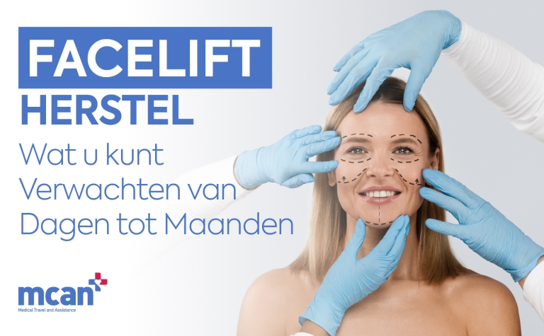 Facelift herstel: wat u kunt verwachten van dagen tot maanden 6 NL Facelift Recovery Timeline Facelift herstel: wat u kunt verwachten van dagen tot maanden
