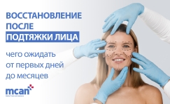 Восстановление после подтяжки лица: чего ожидать от первых дней до месяцев