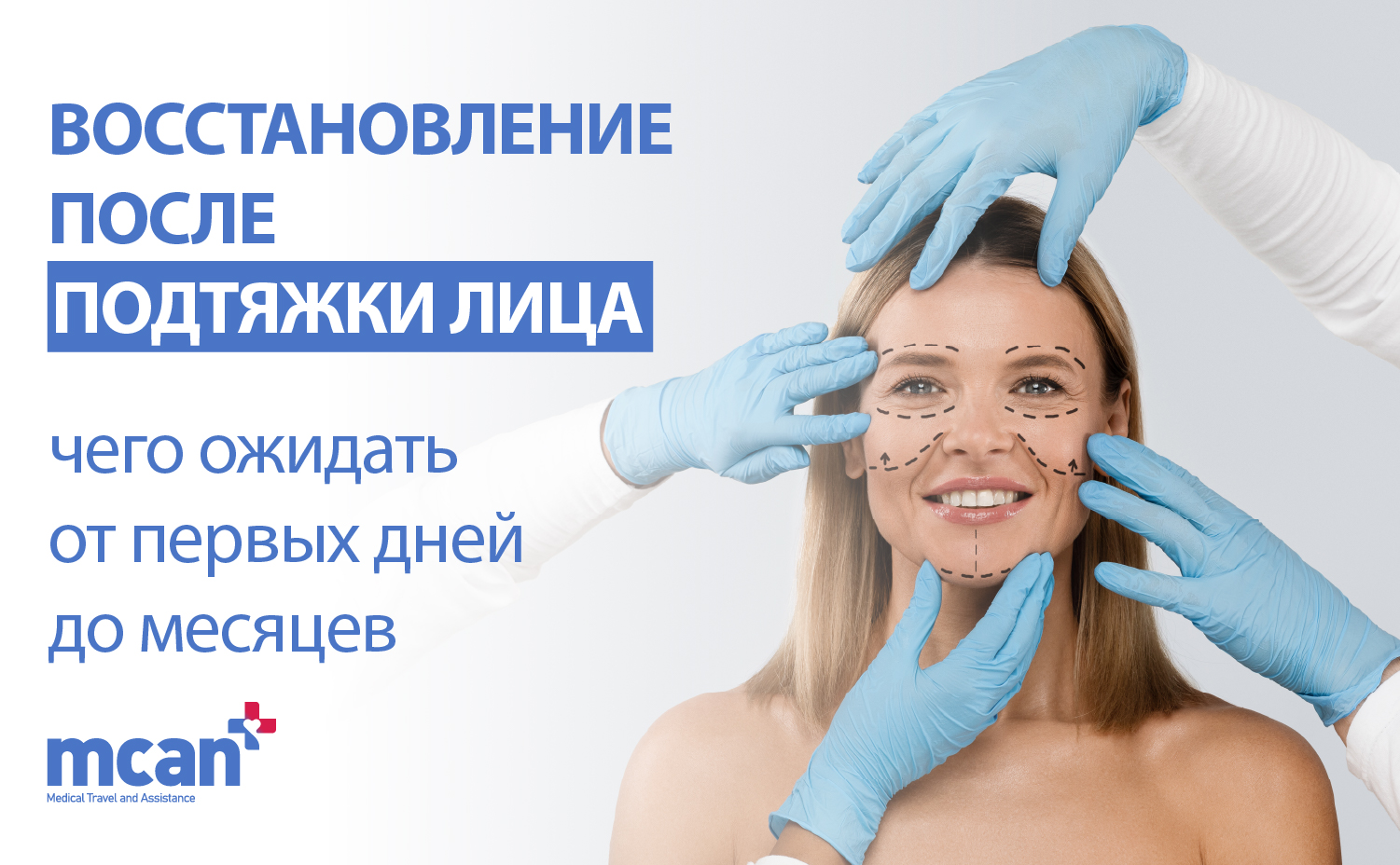 Восстановление после подтяжки лица: чего ожидать от первых дней до месяцев