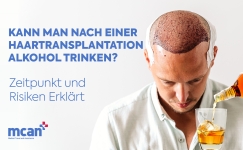 de Can You Drink Alcohol After a Hair Transplant