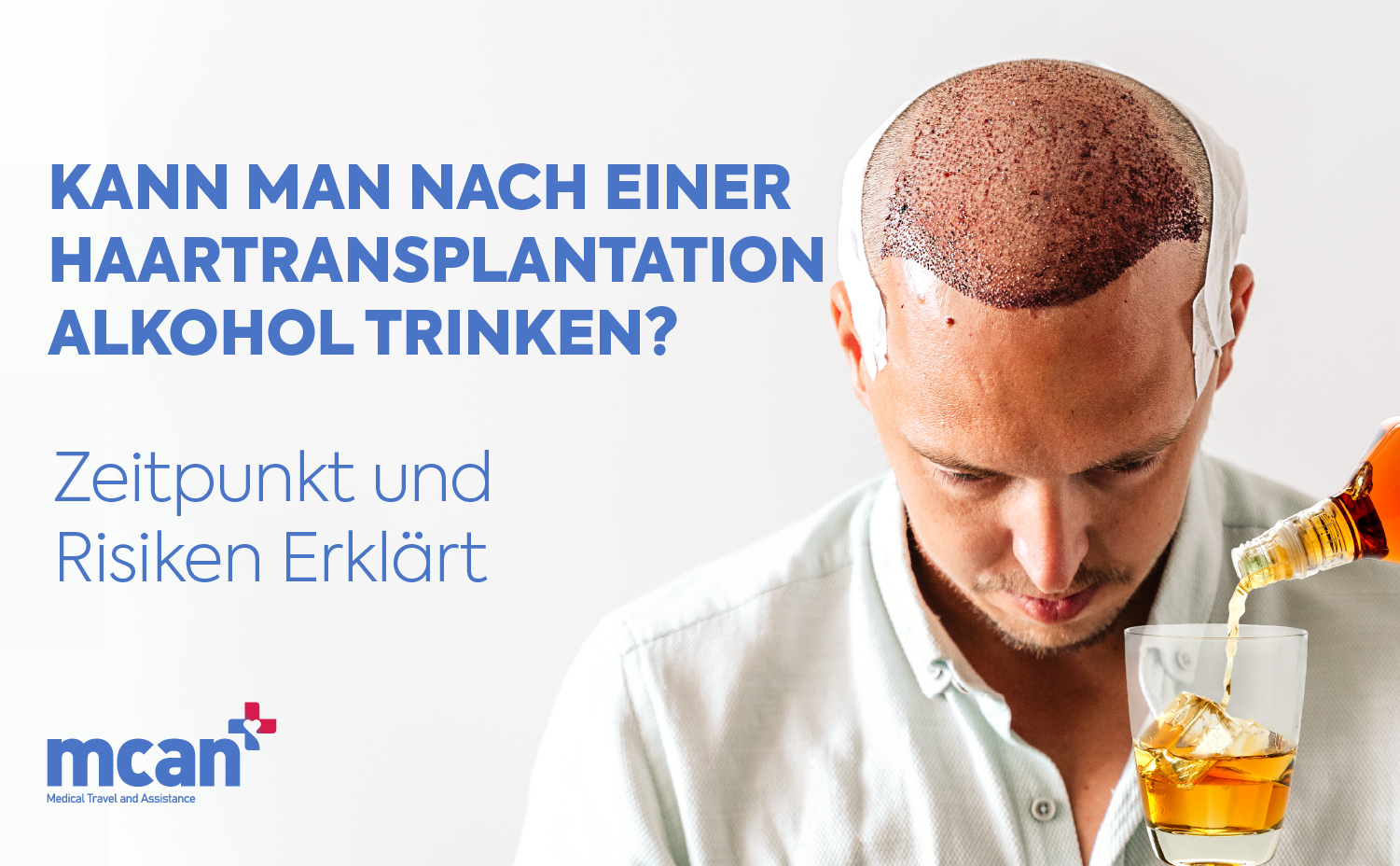 de Can You Drink Alcohol After a Hair Transplant