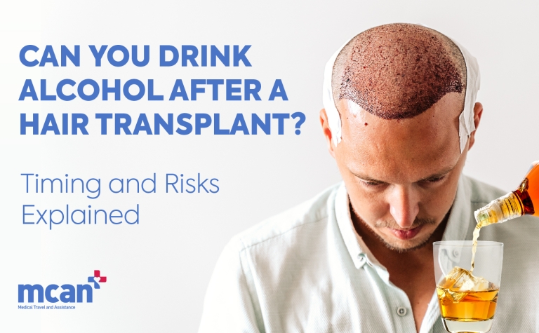 Can You Drink Alcohol After a Hair Transplant? Timing and Risks Explained 5 en Can You Drink Alcohol After a Hair Transplant en Can You Drink Alcohol After a Hair Transplant