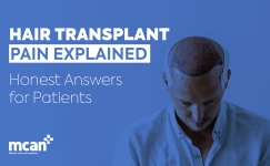 en Hair Transplant Pain Explained