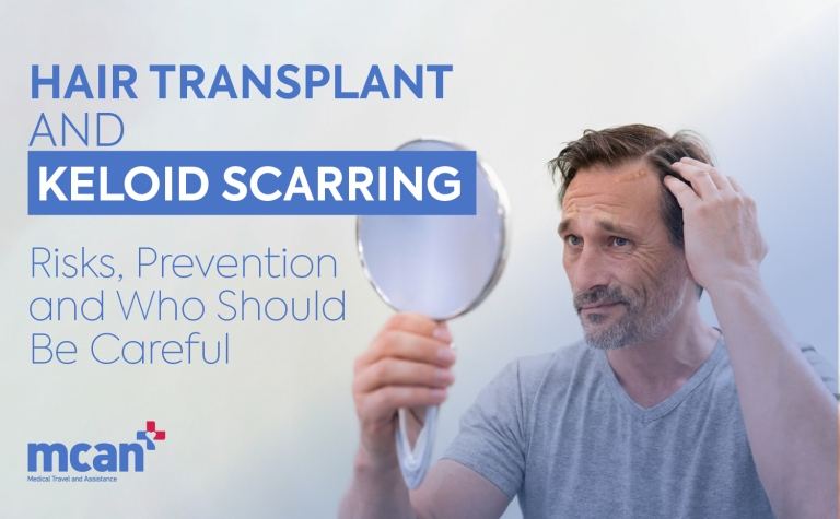Hair Transplant and Keloid Scarring: Risks, Prevention, and Who Should Be Careful 4 en Hair Transplant and Keloid Scarring en Hair Transplant and Keloid Scarring