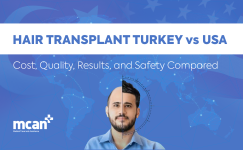 en Hair transplant turkey vs usa