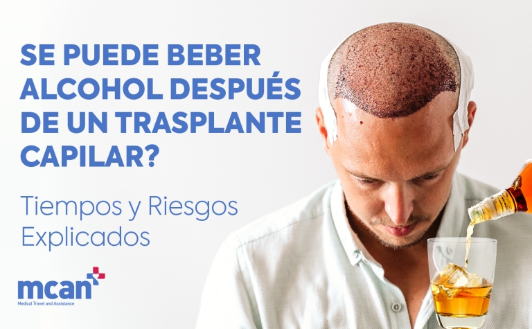 ¿Se puede beber alcohol después de un trasplante capilar? Tiempos y riesgos explicados