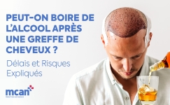 fr Can You Drink Alcohol After a Hair Transplant