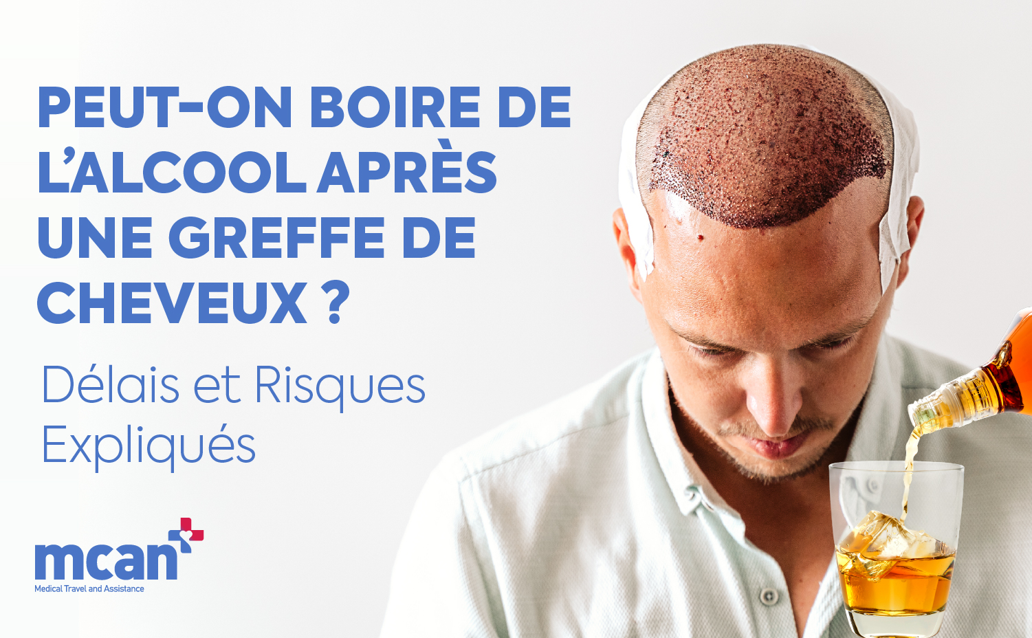 fr Can You Drink Alcohol After a Hair Transplant