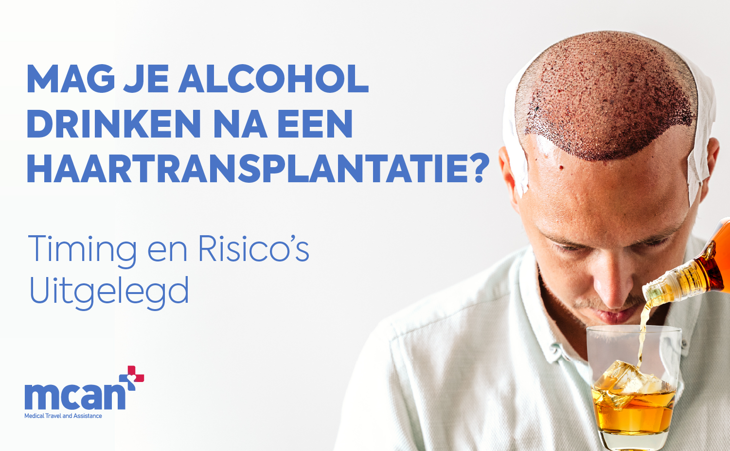 nl Can You Drink Alcohol After a Hair Transplant