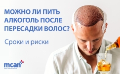 ru Can You Drink Alcohol After a Hair Transplant