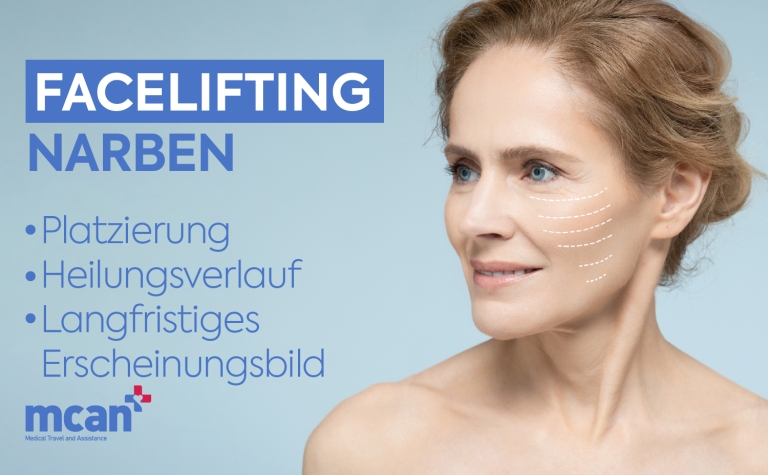 Facelifting Narben: Platzierung, Heilungsverlauf und langfristiges Erscheinungsbild 6 DE Facelift SCARS Facelifting Narben: Platzierung, Heilungsverlauf und langfristiges Erscheinungsbild