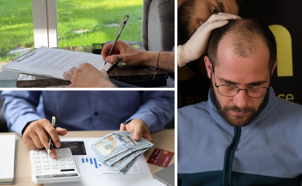 How Hair Transplant Pricing Works in the USA