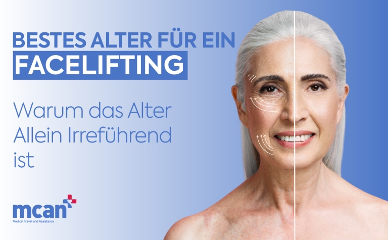Bestes Alter für ein Facelifting: Warum das Alter allein irreführend ist 5 de Best Age for a Facelift Bestes Alter für ein Facelifting: Warum das Alter allein irreführend ist