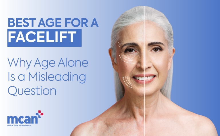 Facelift in Turkey 82 en Best Age for a Facelift Best Age for a Facelift: Why Age Alone Is a Misleading Question