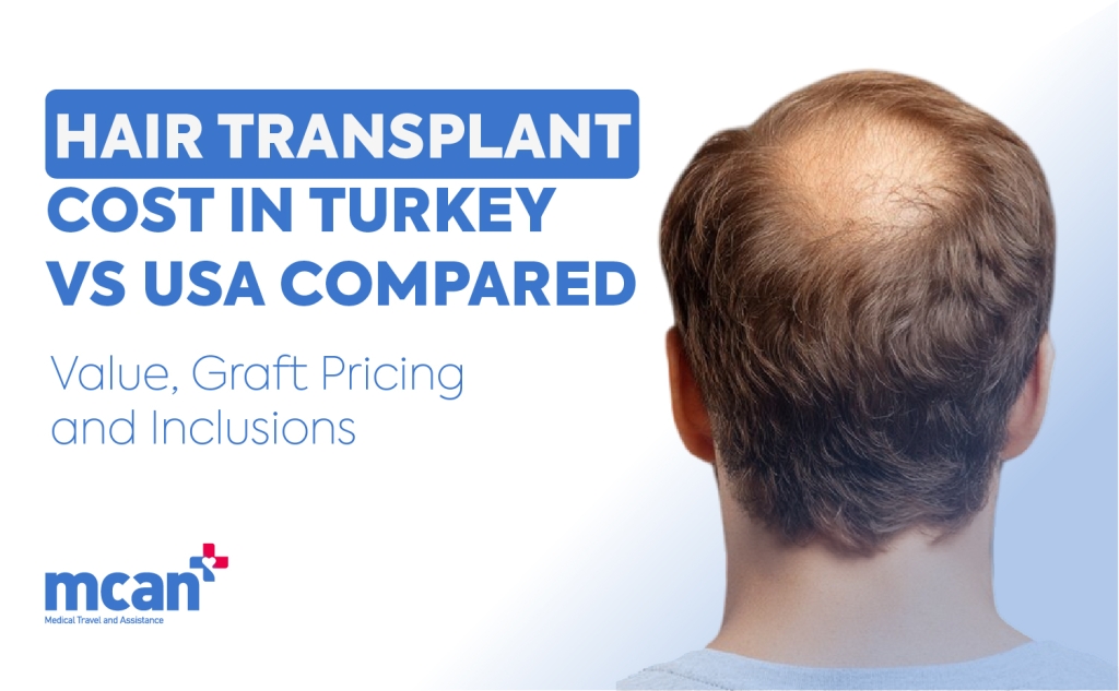 en Hair Transplant Cost in Turkey vs USA Compared
