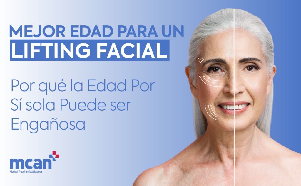 Mejor edad para un lifting facial: por qué la edad por sí sola puede ser engañosa