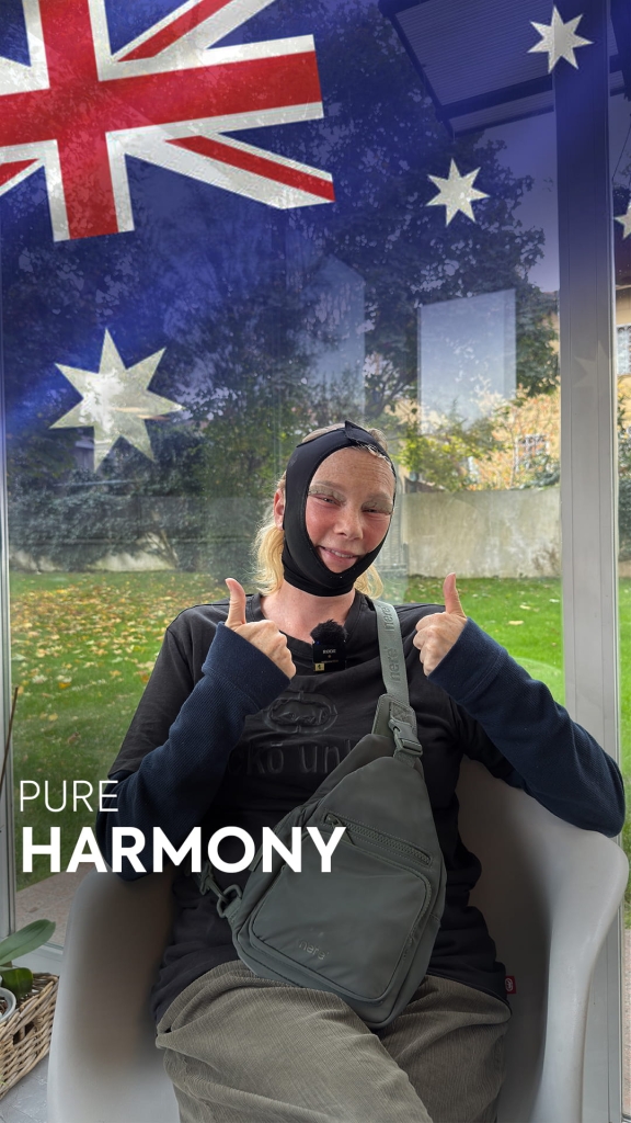 Facelift in Turkey 33 facelift story 4 1 facelift story 4 1