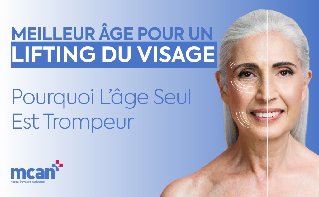 Meilleur âge pour un lifting du visage : pourquoi l’âge seul est trompeur