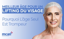 Meilleur âge pour un lifting du visage : pourquoi l’âge seul est trompeur