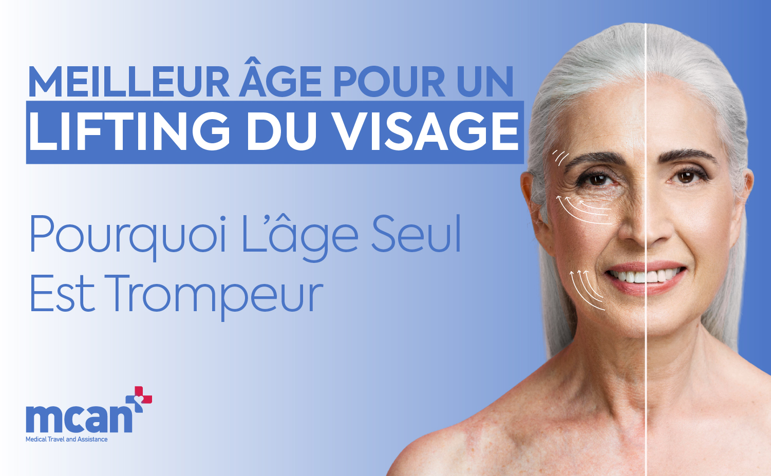 Meilleur âge pour un lifting du visage : pourquoi l’âge seul est trompeur