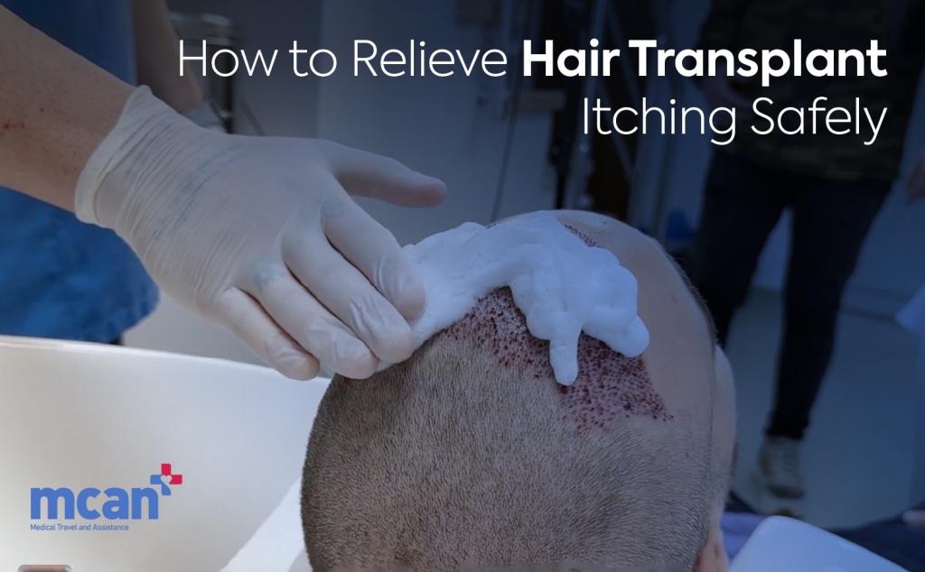 EN How to Relieve Hair Transplant Itching Safely