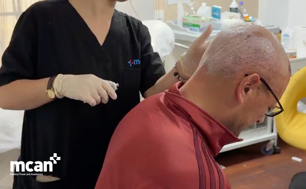 Managing Itching After Your Hair Transplant in Turkey with MCAN Health