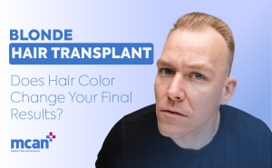 Blonde Hair Transplant: Does Hair Color Change Your Final Results? 3 Blonde Hair Transplant Blonde Hair Transplant