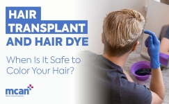 Hair Transplant and Hair Dye