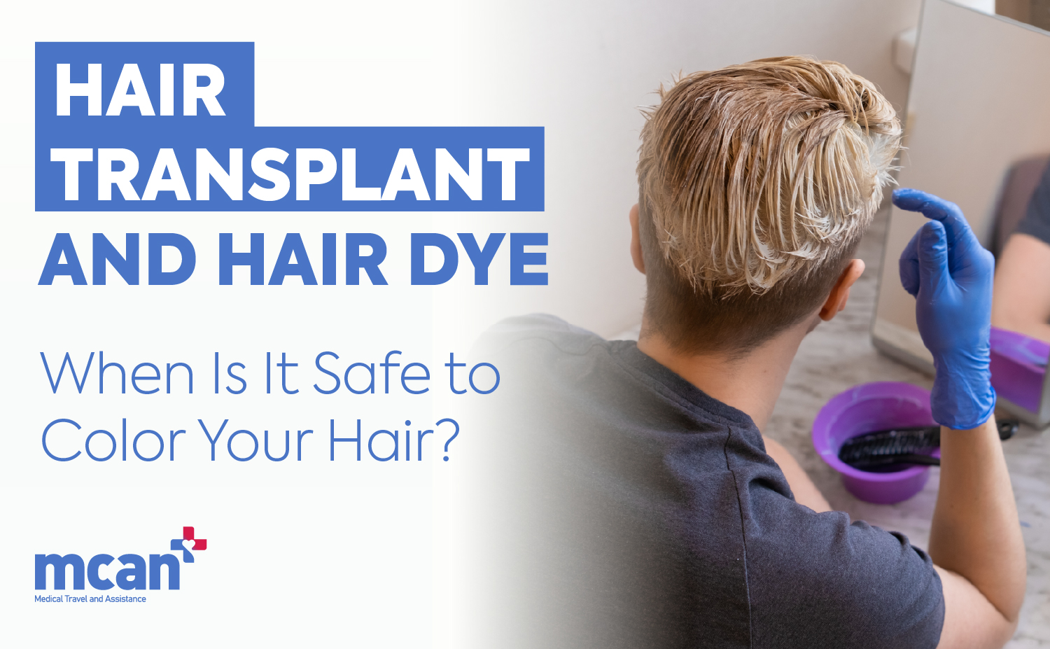 Hair Transplant and Hair Dye