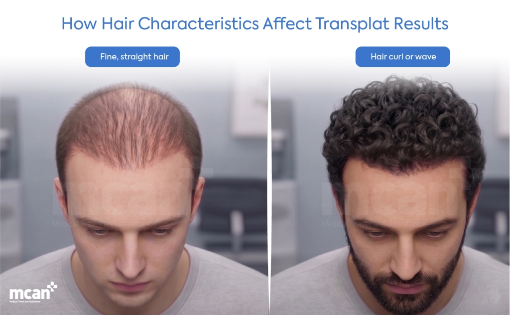 Blonde Hair Transplant: Does Hair Color Change Your Final Results? 3 How Hair Characteristics Affect Transplant Results How Hair Characteristics Affect Transplant Results