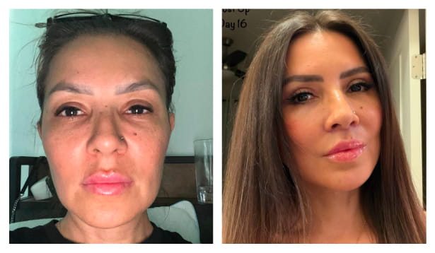 Before After
