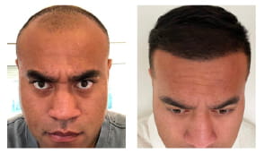 Home EN 16 BANNER 1 2 Before After