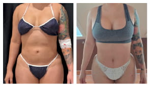 Home EN 12 BANNER 3 2 Before After