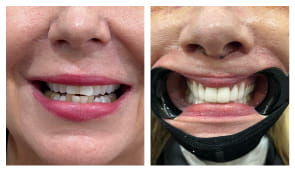 Home EN 18 BANNER 6 2 Before After