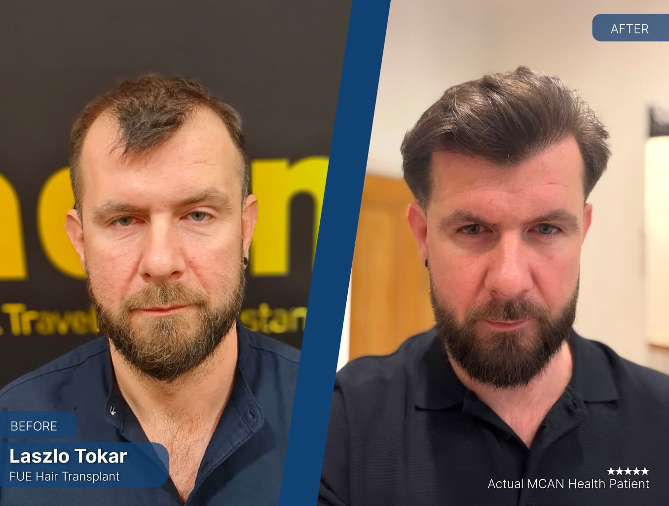 Before After 4